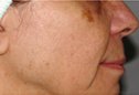 Dr. Eric Berkowitz MD