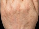 Dr. Eric Berkowitz MD