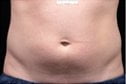Dr. Eric Berkowitz MD
