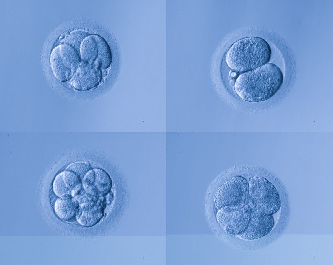 Bahçeci IVF Centers