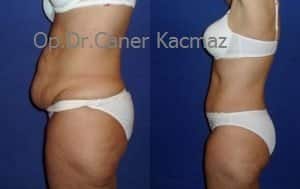Dr. Caner Kaçmaz Clinic