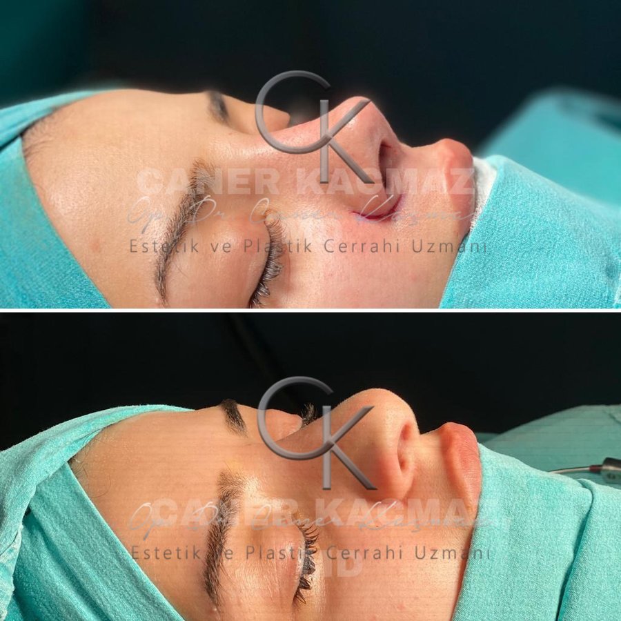Dr Caner Kacmaz Clinic