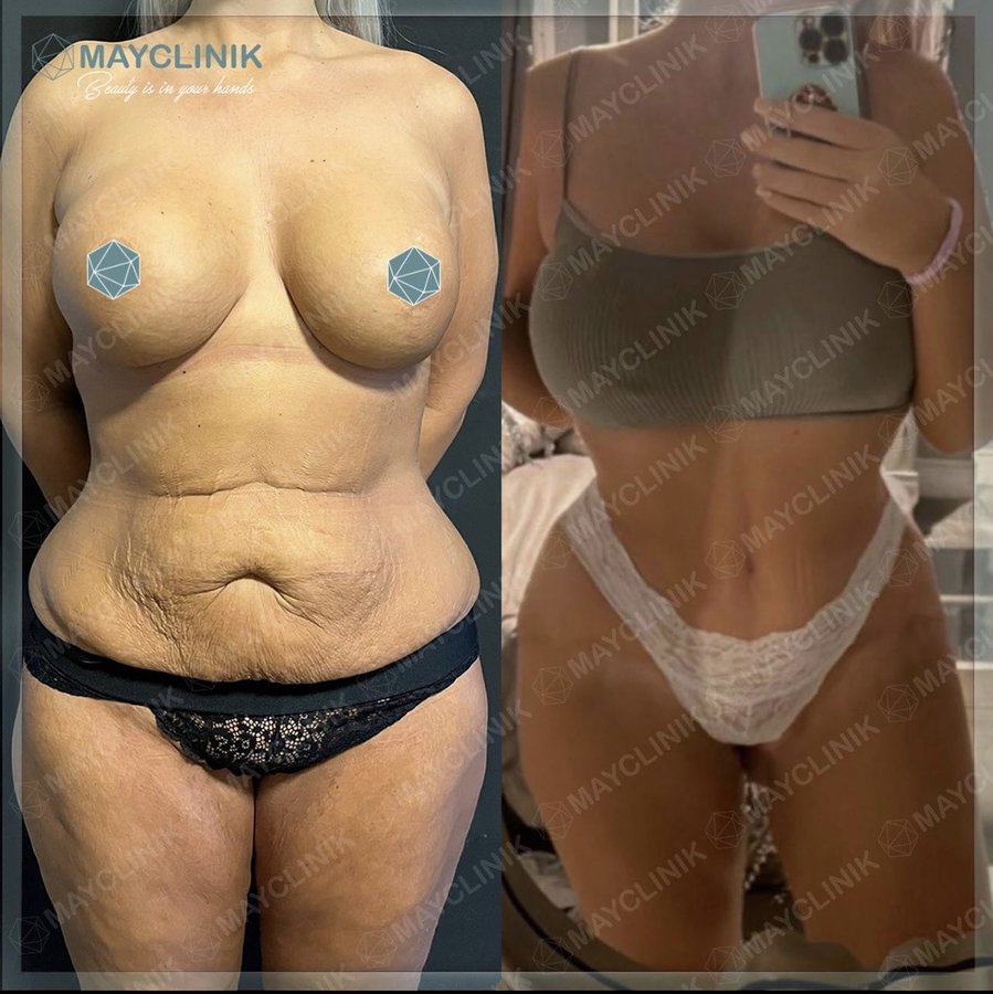 MayClinik Plastic Surgery