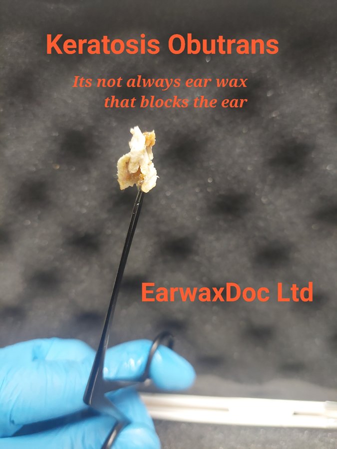 EarwaxDoc Ltd - Ear Wax Removal Microsuction W'ton