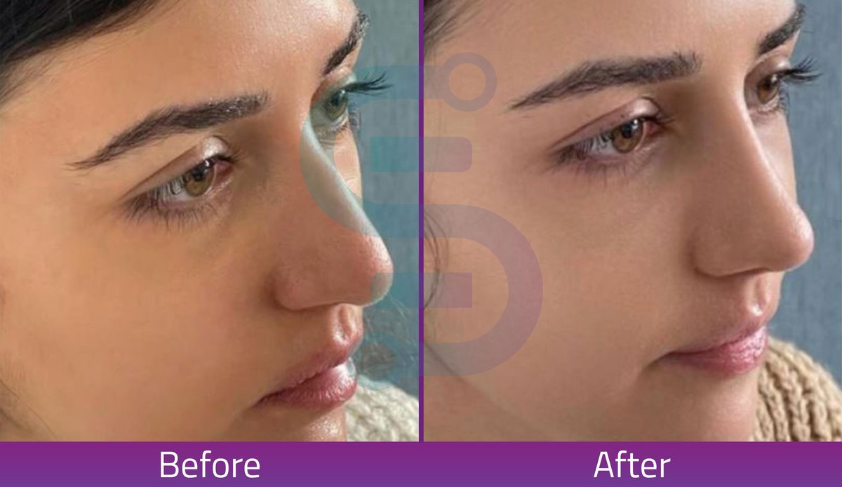 Estexper Beauty Clinic