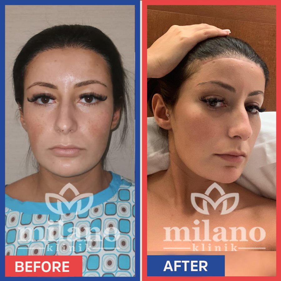 Este Milano
