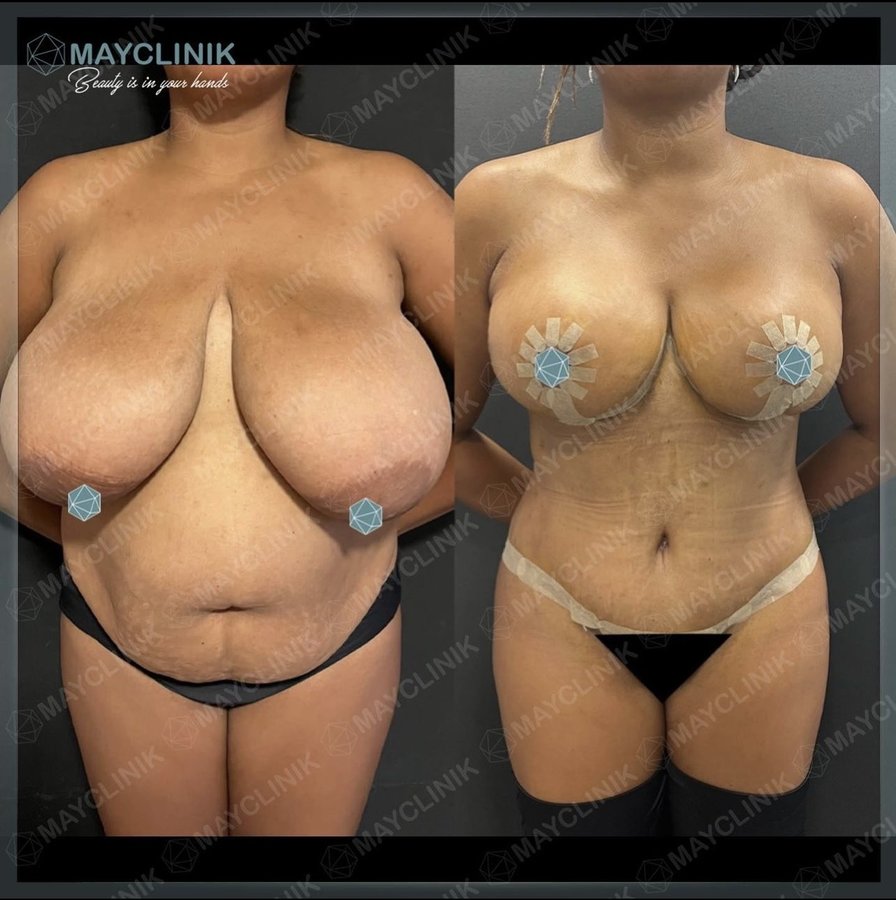 MayClinik Plastic Surgery