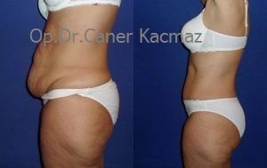 Dr Caner Kacmaz Clinic