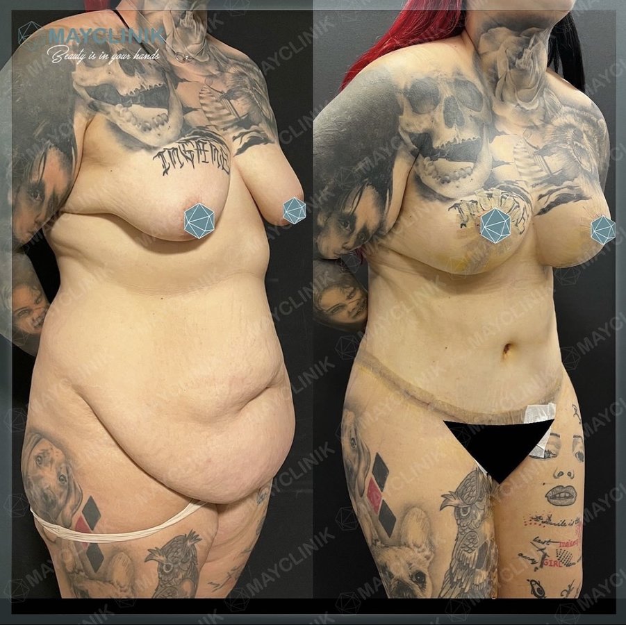 MayClinik Plastic Surgery